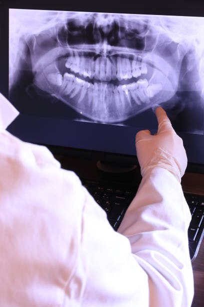 Best Chipped Tooth Repair Near Me  in Argentine, MI
